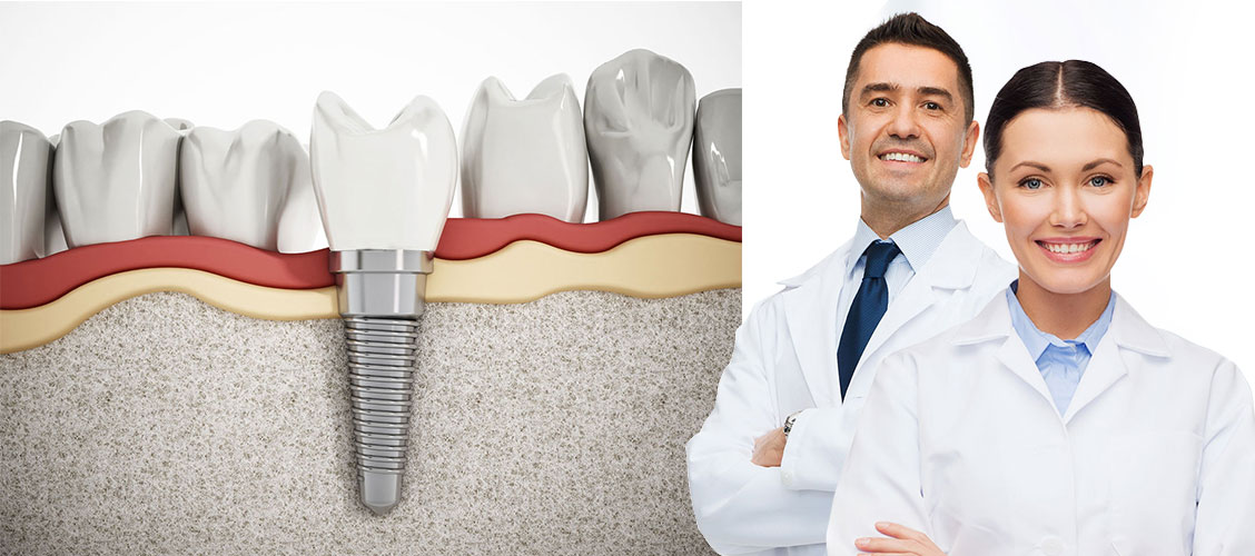 Спб стоматологии имплантации. Jorge Dental Studio Chisinau.