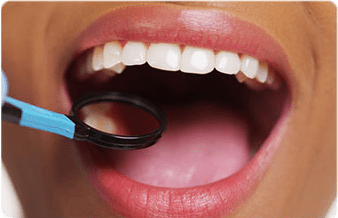 dental-exam-checkup-turk